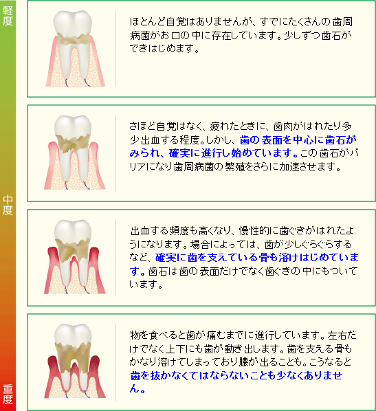 歯周病の進行表